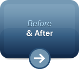 before & after photos